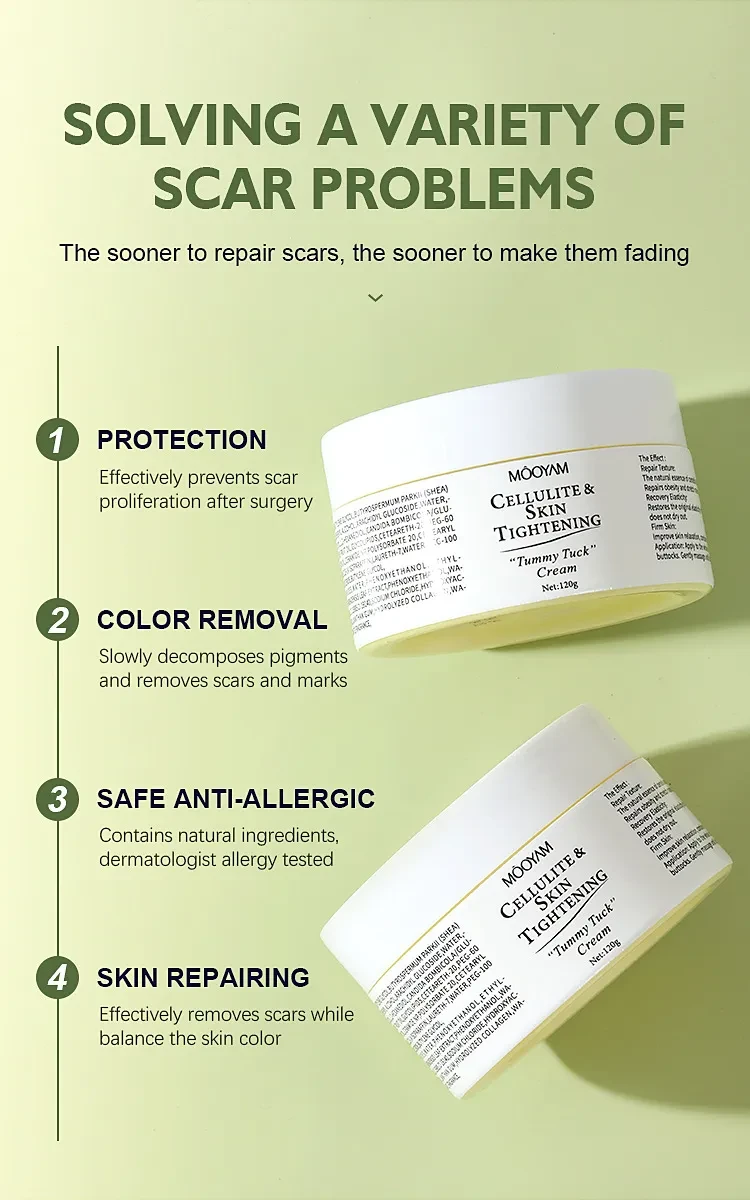 Stretch Mark Cream Fat Body Pattern Recovery Cream