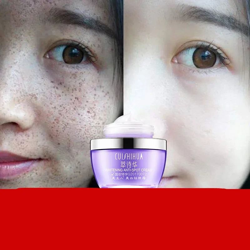 Whitening Freckle Cream