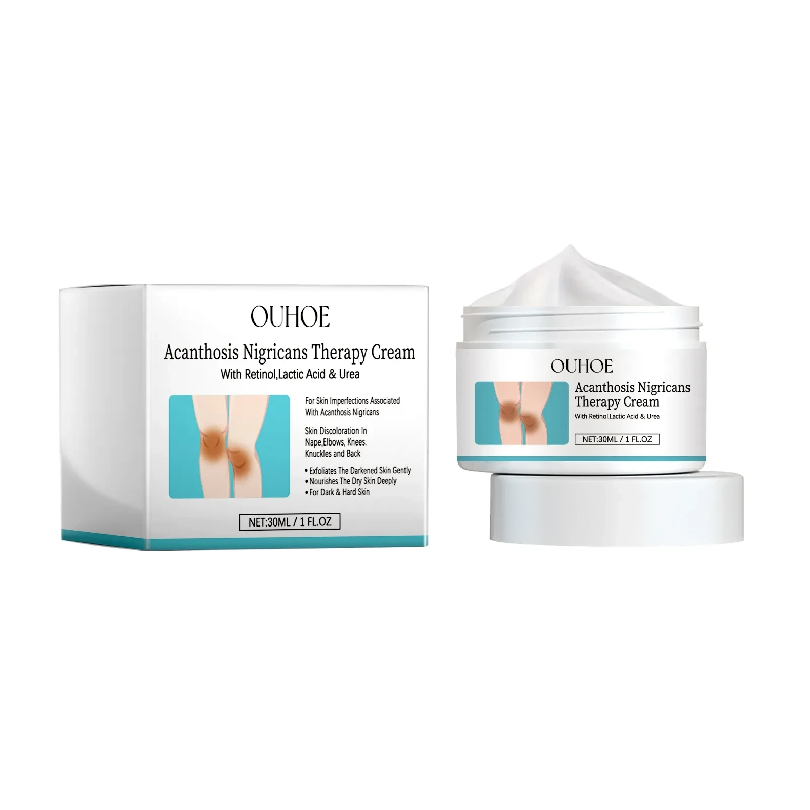 Acanthosis Nigricans Therapy Cream